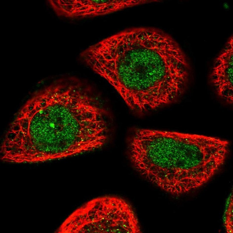 Immunocytochemistry/Immunofluorescence: ABCA12 Antibody [NBP1-85125] - Immunofluorescent staining of human cell line A-431 shows positivity in nucleus but not nucleoli.