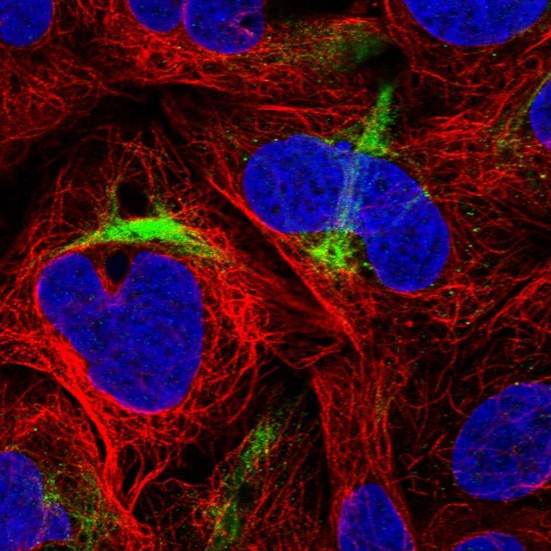 Immunocytochemistry/Immunofluorescence: PNPLA1 Antibody [NBP1-85172] - Staining of human cell line U-2 OS shows positivity in cytoskeleton (intermediate filaments).
