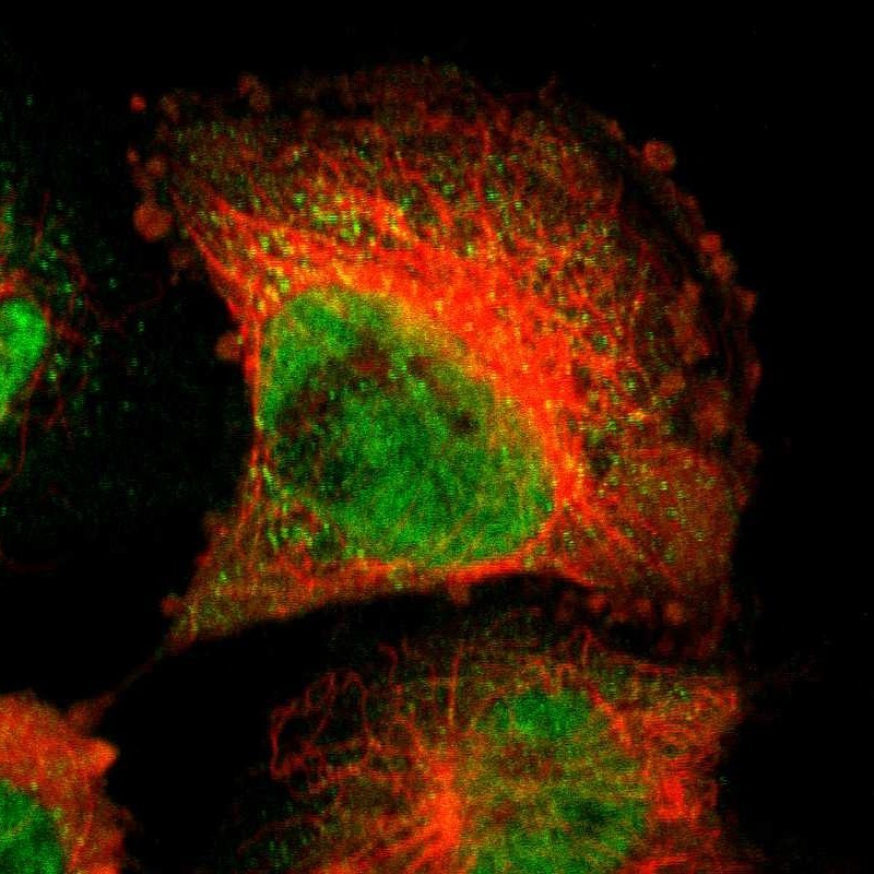 Immunocytochemistry/Immunofluorescence: PDXP Antibody [NBP1-85178] - Staining of human cell line U-251MG shows positivity in nucleus but not nucleoli & cytoplasm.