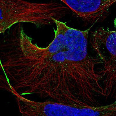 Immunocytochemistry/Immunofluorescence: DGKG Antibody [NBP1-85316] Staining of human cell line U-2 OS shows positivity in plasma membrane & cytoplasm.