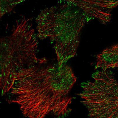 Immunocytochemistry/Immunofluorescence: COP1 Antibody [NBP1-85516] Staining of human cell line U-251MG shows positivity in nucleus but not nucleoli & focal adhesions.