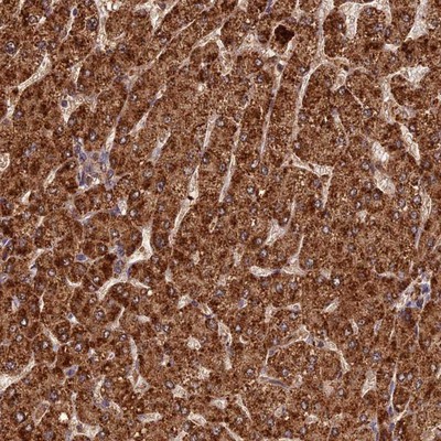 Immunohistochemistry-Paraffin: Coronin 3 Antibody [NBP1-85506] - Staining of human liver shows strong cytoplasmic positivity in hepatocytes.