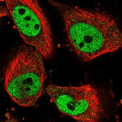 Immunocytochemistry/Immunofluorescence: VPS33A Antibody [NBP1-85868] - Immunofluorescent staining of human cell line U-251 MG shows positivity in nucleus but not nucleoli.