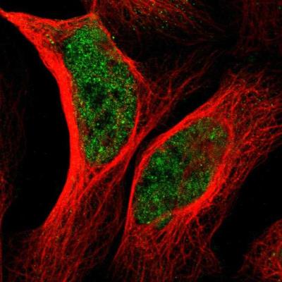 Immunocytochemistry/Immunofluorescence: PCDH9 Antibody [NBP1-86073] - Immunofluorescent staining of human cell line U-2 OS shows positivity in nuclei but not nucleoli.