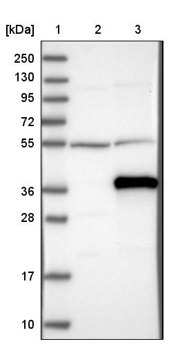 Western Blot: C1orf111 Antibody [NBP1-86319] - Lane 1: Marker [kDa] 250, 130, 95, 72, 55, 36, 28, 17, 10<br/>Lane 2: Negative control (vector only transfected HEK293T lysate)<br/>Lane 3: Over-expression lysate (Co-expressed with a C-terminal myc-DDK tag (~3.1 kDa) in mammalian HEK293T cells, LY405470)