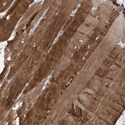 Immunohistochemistry-Paraffin: C1orf111 Antibody [NBP1-86319] - Staining of human skeletal muscle shows strong cytoplasmic positivity in myocytes.