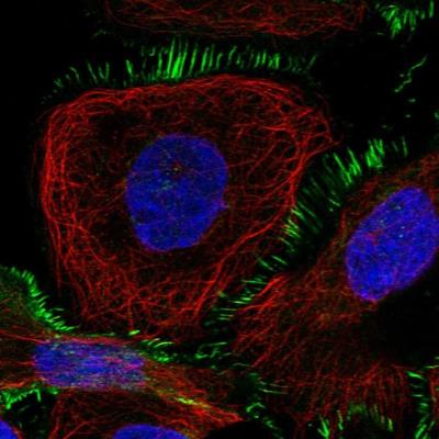 Immunocytochemistry/Immunofluorescence: ASB5 Antibody [NBP1-86375] - Immunofluorescent staining of human cell line A-431 shows positivity in plasma membrane.