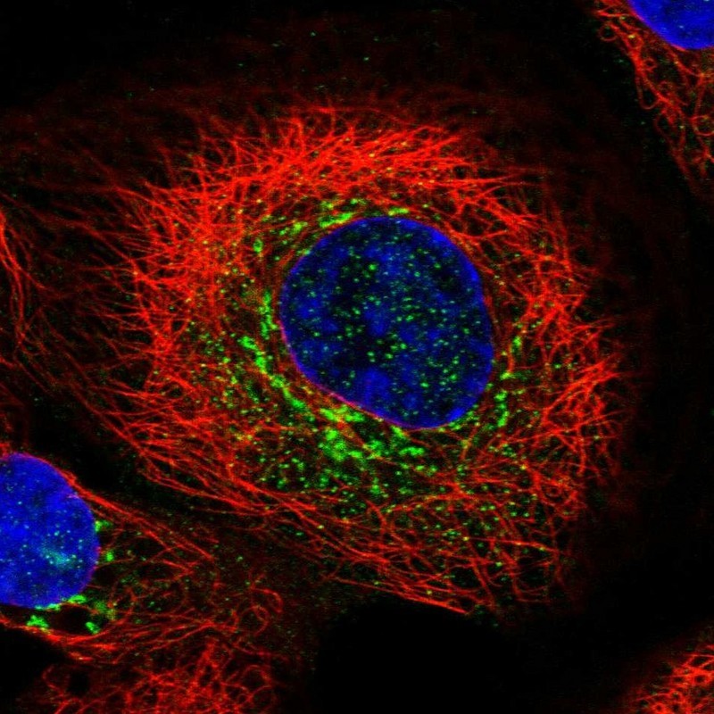 Immunocytochemistry/Immunofluorescence: MPZL3 Antibody [NBP1-86368] - Immunofluorescent staining of human cell line A-431 shows positivity in golgi apparatus.