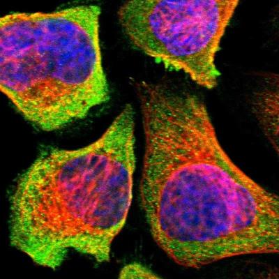 Immunocytochemistry/Immunofluorescence: ACSF3 Antibody [NBP1-86490] - Immunofluorescent staining of human cell line A-431 shows positivity in cytoplasm.