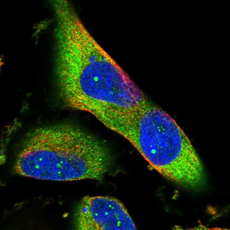 Immunocytochemistry/Immunofluorescence: ALS2CR8 Antibody [NBP1-86627] - Immunofluorescent staining of human cell line U-251MG shows positivity in nucleoli & cytoplasm.