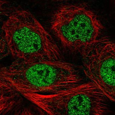 Immunocytochemistry/Immunofluorescence: MCM9 Antibody [NBP1-86740] - Immunofluorescent staining of human cell line A-431 shows positivity in nucleus but not nucleoli.