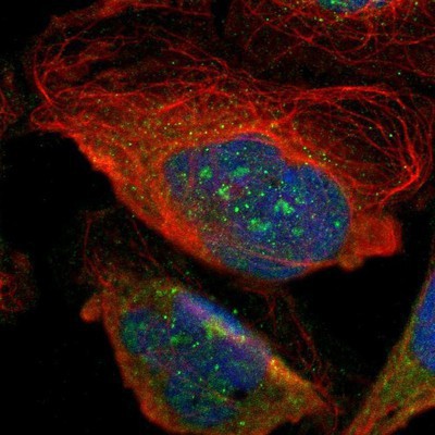 Immunocytochemistry/Immunofluorescence: Synphilin-1 Antibody [NBP1-86977] Staining of human cell line U-2 OS shows positivity in nucleus, nucleoli & cytoplasm.