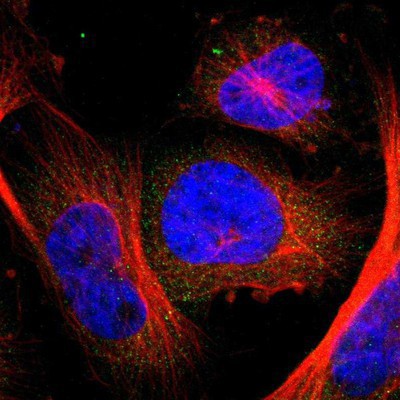 Immunocytochemistry/Immunofluorescence: PANK4 Antibody [NBP1-83831] Staining of human cell line U-251MG shows positivity in cytoplasm.