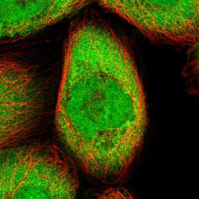 Immunocytochemistry/Immunofluorescence: FKBP14 Antibody [NBP1-83891] - Staining of human cell line A-431 shows positivity in nucleus but not nucleoli & cytoplasm.