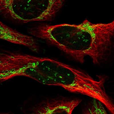 Immunocytochemistry/Immunofluorescence: MBD5 Antibody [NBP1-83775] - Staining of human cell line U-2 OS shows positivity in nucleoli & mitochondria.