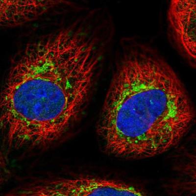 Immunocytochemistry/Immunofluorescence: FGFR1OP2 Antibody [NBP1-84148] - Staining of human cell line A-431 shows positivity in mitochondria.