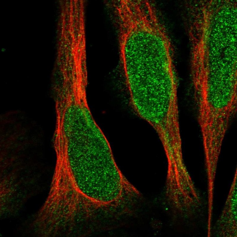 Immunocytochemistry/Immunofluorescence: C6orf225 Antibody [NBP1-84138] - Staining of human cell line U-2 OS shows positivity in nucleus.
