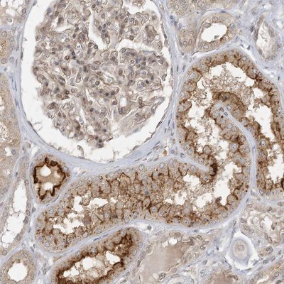 Immunohistochemistry-Paraffin: C6orf225 Antibody [NBP1-84138] - Staining of human kidney shows strong cytoplasmic and membranous positivity in a subset of tubules.