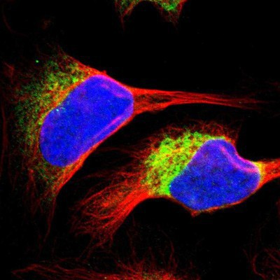 Immunocytochemistry/Immunofluorescence: RRBP1 Antibody [NBP1-83958] - Staining of human cell line U-2 OS shows positivity in endoplasmic reticulum.