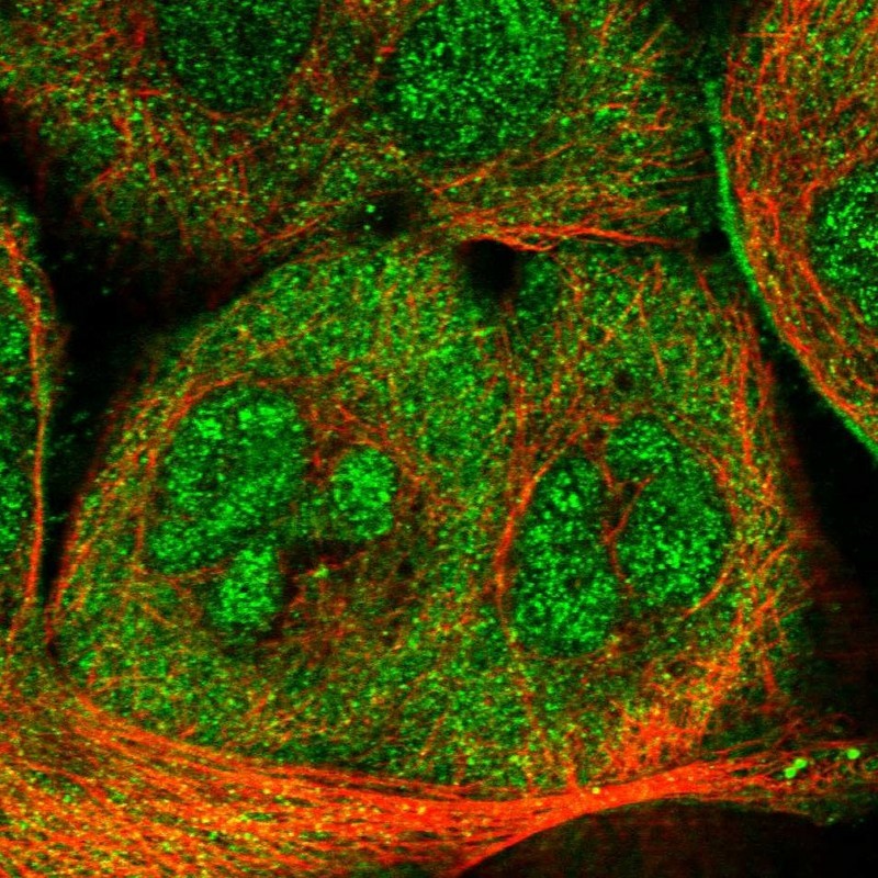 Immunocytochemistry/Immunofluorescence: DNAJC10 Antibody [NBP1-83965] - Staining of human cell line A-431 shows positivity in nucleus & cytoplasm.