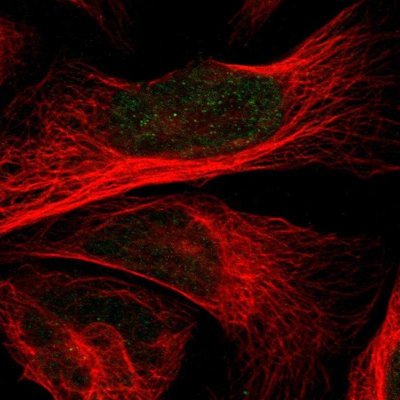 Immunocytochemistry/Immunofluorescence: RPL15 Antibody [NBP1-84018] - Staining of human cell line U-2 OS shows positivity in nuclei.