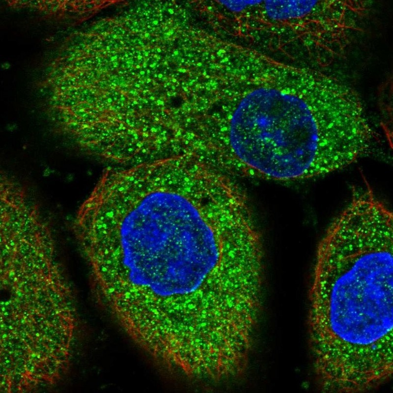 Immunocytochemistry/Immunofluorescence: SNX3 Antibody [NBP1-81792] - Staining of human cell line A-431 shows positivity in cytoplasm & vesicles.