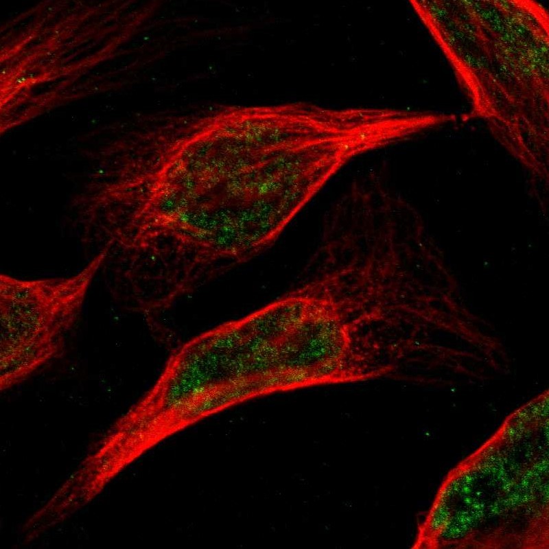 Immunocytochemistry/Immunofluorescence: RGMB Antibody [NBP1-81879] - Staining of human cell line U-2 OS shows positivity in nuclei but not nucleoli.