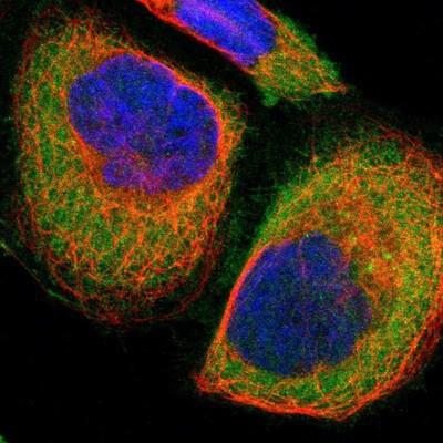 Immunocytochemistry/Immunofluorescence: SARG Antibody [NBP1-81956] - Staining of human cell line A-431 shows positivity in plasma membrane & cytoplasm.