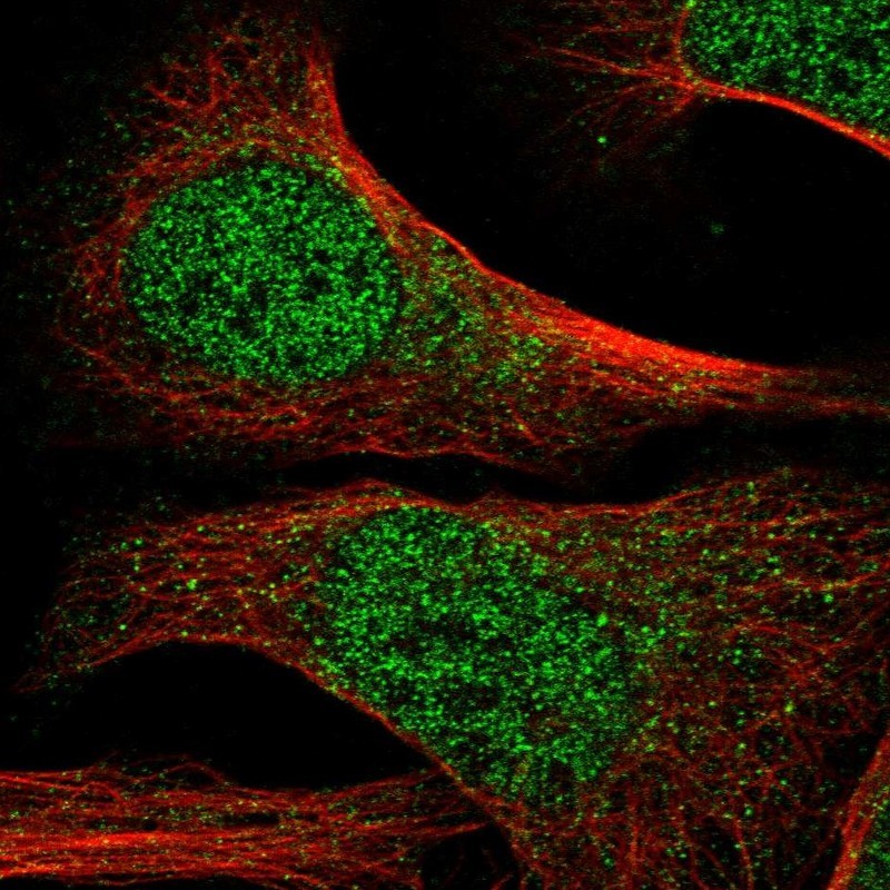 Immunocytochemistry/Immunofluorescence: CXorf59 Antibody [NBP1-81955] - Staining of human cell line U-2 OS shows positivity in nucleus but not nucleoli & cytoplasm.