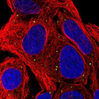 Immunocytochemistry/Immunofluorescence: HFM1 Antibody [NBP1-81954] - Staining of human cell line U-2 OS shows positivity in vesicles.