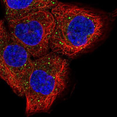 Immunocytochemistry/Immunofluorescence: WDR16 Antibody [NBP1-81946] Staining of human cell line A-431 shows positivity in vesicles.