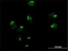 Immunocytochemistry/Immunofluorescence: GOSR1 Antibody [H00009527-B01] - Immunofluorescence of purified MaxPab antibody to GOSR1 on HeLa cell. [antibody concentration 10 ug/ml]