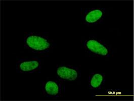 Immunocytochemistry/Immunofluorescence: HMG20A Antibody [H00010363-B01] - Immunofluorescence of purified MaxPab antibody to HMG20A on HepG2 cell. [antibody concentration 10 ug/ml]