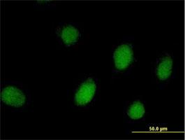 Immunocytochemistry/Immunofluorescence: RHOXF2 Antibody [H00084528-B01] - Immunofluorescence of purified MaxPab antibody to PEPP-2 on HeLa cell. [antibody concentration 10 ug/ml]