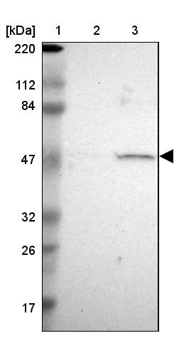 Western Blot: Nicotinic Acetylcholine Receptor beta Antibody [NBP1-84478] - Lane 1: Marker [kDa] 220, 112, 84, 47, 32, 26, 17<br/>Lane 2: Human cell line RT-4<br/>Lane 3: Human cell line U-251MG sp