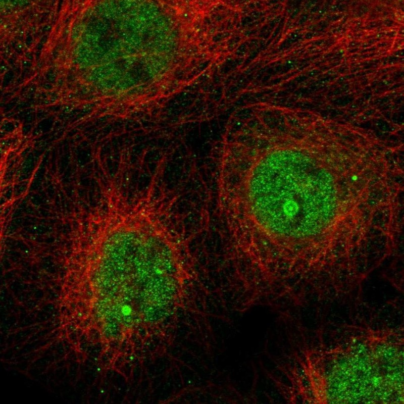 Immunocytochemistry/Immunofluorescence: CLEC4F Antibody [NBP1-84447] - Staining of human cell line A-431 shows positivity in nucleus but not nucleoli.