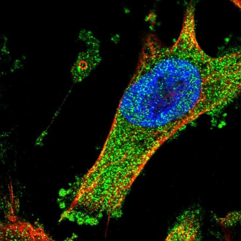 Immunocytochemistry/Immunofluorescence: ABCC9 Antibody [NBP1-84436] - Staining of human cell line U-251MG shows positivity in nucleus but not nucleoli & cytoplasm.
