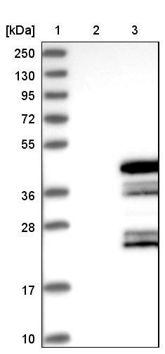 Western Blot: C6orf106 Antibody [NBP1-84224] - Lane 1: Marker [kDa] 250, 130, 95, 72, 55, 36, 28, 17, 10<br/>Lane 2: Negative control (vector only transfected HEK293T lysate)<br/>Lane 3: Over-expression lysate (Co-expressed with a C-terminal myc-DDK tag (~3.1 kDa) in mammalian HEK293T cells, LY411330)