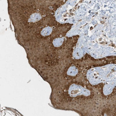 Immunohistochemistry-Paraffin: C6orf106 Antibody [NBP1-84224] - Staining of human skin shows strong cytoplasmic positivity in epidermal cells.
