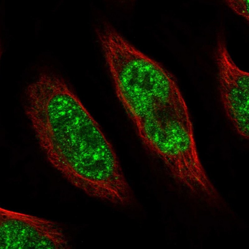 Immunocytochemistry/Immunofluorescence: PHF20L1 Antibody [NBP1-84501] - Staining of human cell line U-2 OS shows positivity in nuclei but not nucleoli.