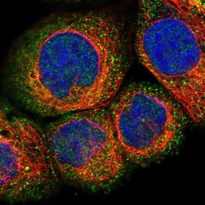 Immunocytochemistry/Immunofluorescence: DENND1A Antibody [NBP1-84742] - Staining of human cell line A-431 shows positivity in nucleus but not nucleoli & cytoplasm.
