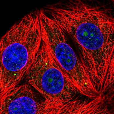Immunocytochemistry/Immunofluorescence: RPL7A Antibody [NBP2-13258] - Staining of human cell line MCF-7 shows positivity in nucleoli & vesicles.