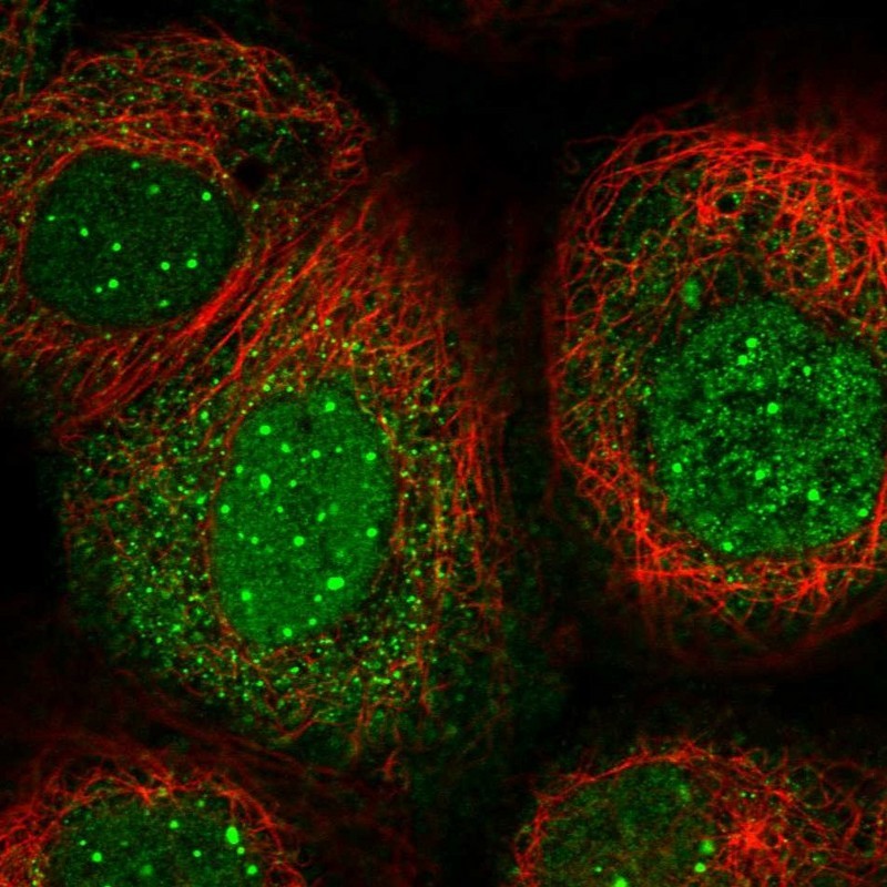 Immunocytochemistry/Immunofluorescence: RPGRIP1 Antibody [NBP2-13249] - Staining of human cell line A-431 shows positivity in nucleus & cytoplasm.