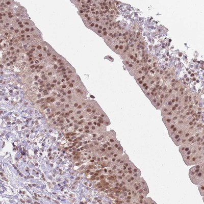 Immunohistochemistry-Paraffin: SmarcAL1 Antibody [NBP2-13352] - Staining of human urinary bladder shows moderate nuclear positivity in urothelial cells.