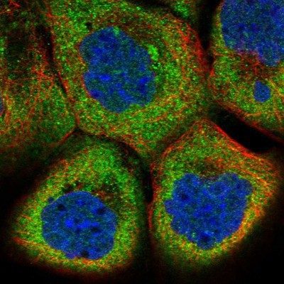 Immunocytochemistry/Immunofluorescence: GDPD2 Antibody [NBP2-14042] Staining of human cell line A-431 shows positivity in cytoplasm.