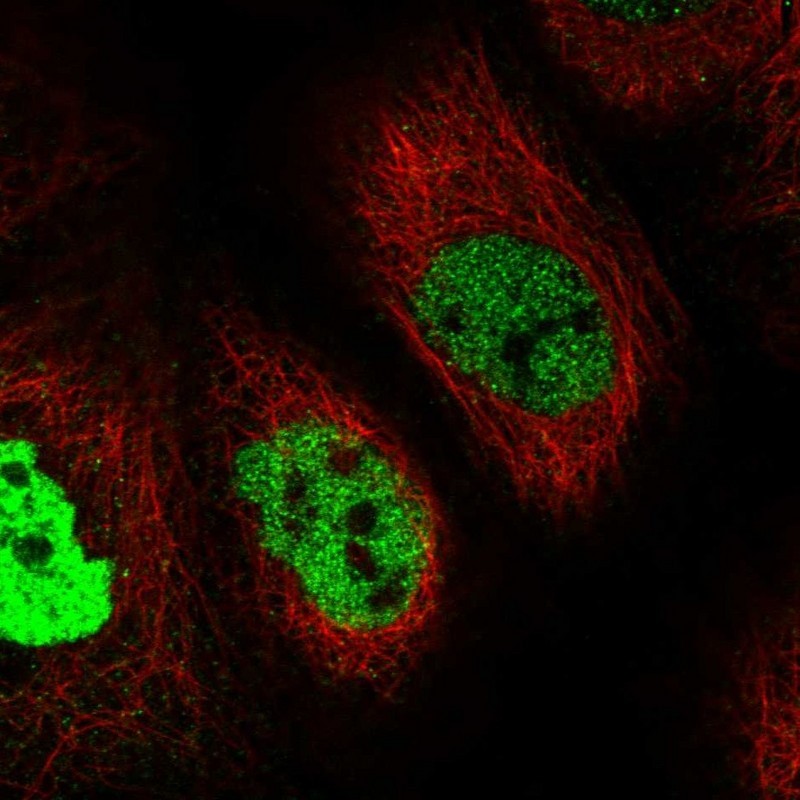 Immunocytochemistry/Immunofluorescence: IFT88 Antibody [NBP2-14117] - Staining of human cell line A-431 shows positivity in nucleus but not nucleoli.