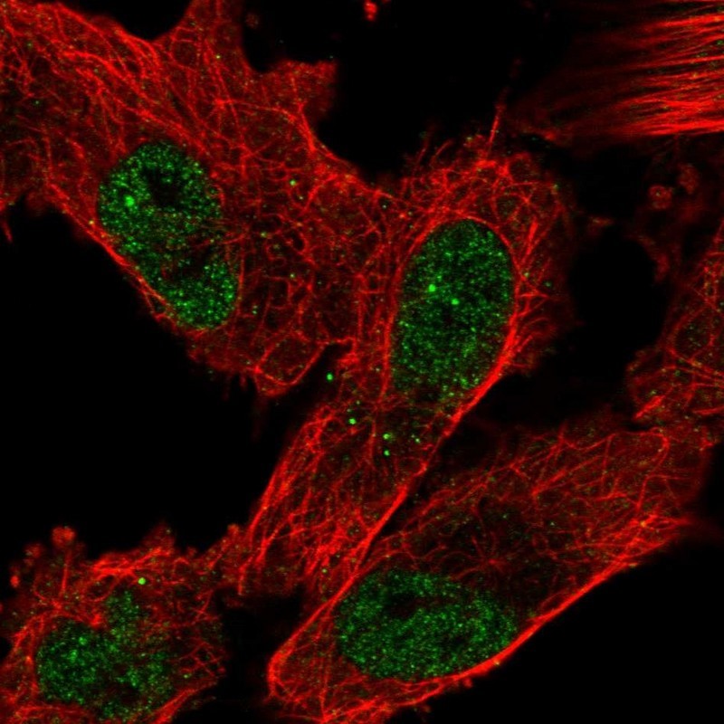 Immunocytochemistry/Immunofluorescence: ALS2CR11 Antibody [NBP2-14285] - Staining of human cell line U-251 MG shows positivity in nucleus but not nucleoli.