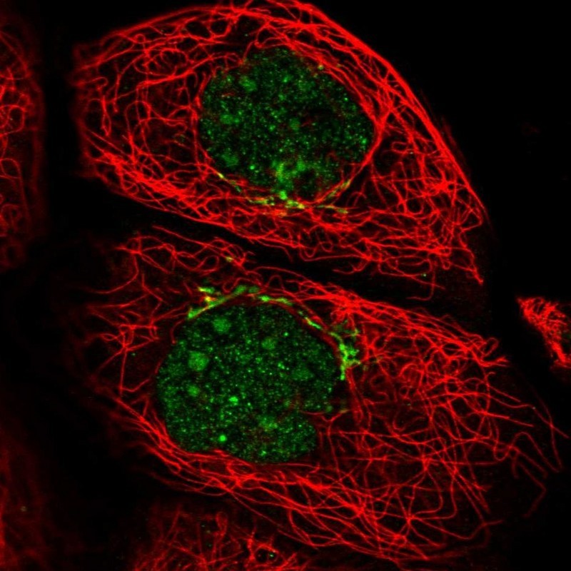 Immunocytochemistry/Immunofluorescence: C3orf37 Antibody [NBP2-14411] - Staining of human cell line A-431 shows positivity in nucleus, nucleoli & golgi apparatus.