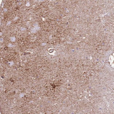 Immunohistochemistry-Paraffin: C3orf37 Antibody [NBP2-14411] - Staining of human hippocampus shows strong cytoplasmic positivity in glial cells.
