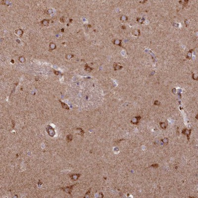 Immunohistochemistry-Paraffin: C15orf60 Antibody [NBP2-14514] - Staining of human lateral ventricle shows strong cytoplasmic positivity in neuronal cells.